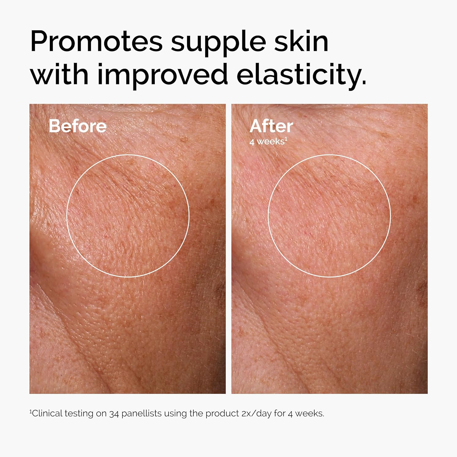The Ordinary Hyaluronic Acid 2% + B5 serum bottle