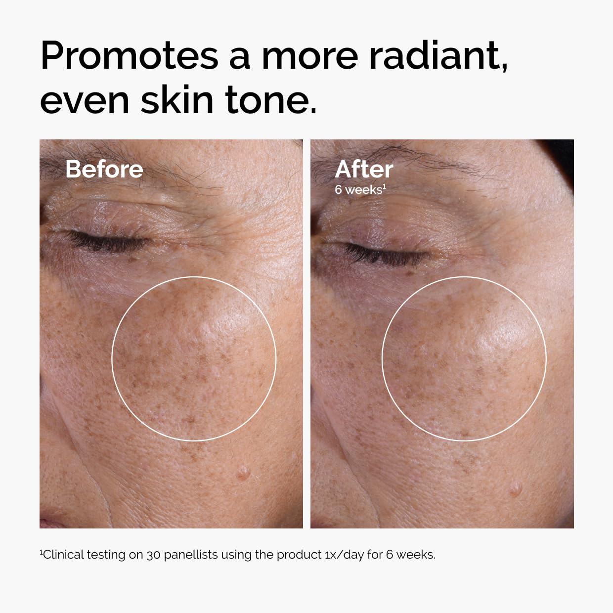 The Ordinary Glycolic Acid 7% Exfoliating Toner, Brightening and Smoothing Daily Toner for More Even-Looking Skin Tone — Overview